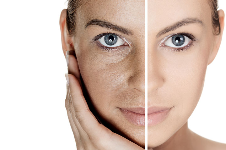 چگونه می‌توان پوستی روشن داشت - درمان‌های طبیعی